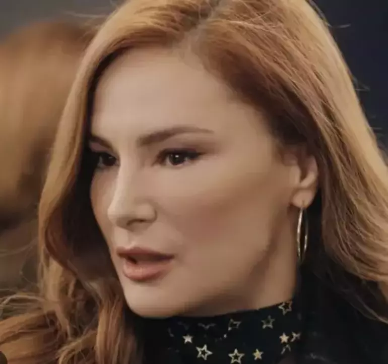 mine tugay'ın göz altı dolgusundan başına bela oldu