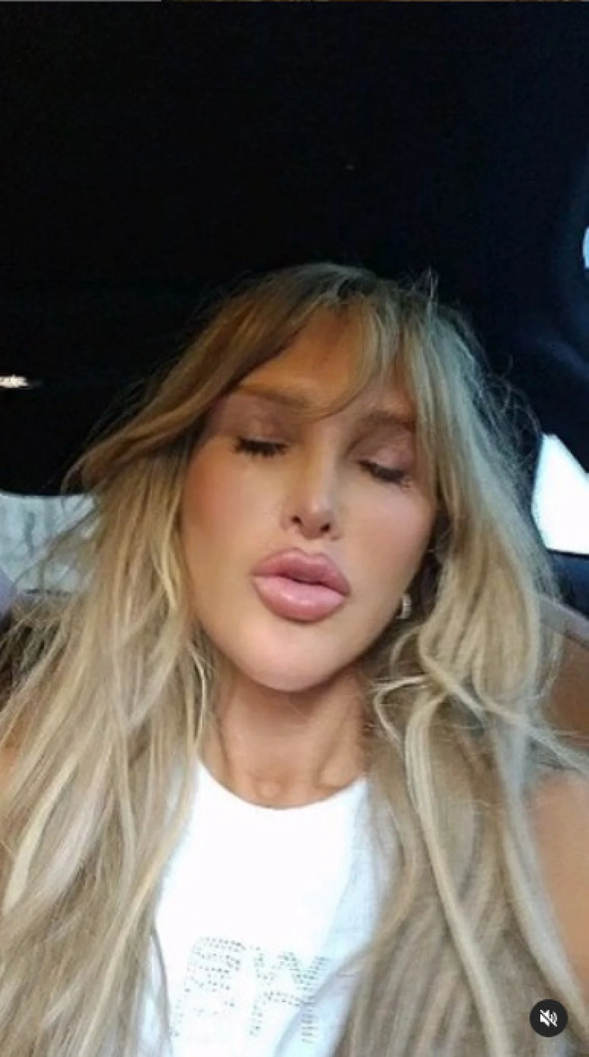 Geçtiğimiz aylarda tüm yüz germe, gıdı ve göz kapağı ameliyatı geçiren Görgüzel, bu operasyonlar sonrasında dikkat çekici bir değişim geçirdi.