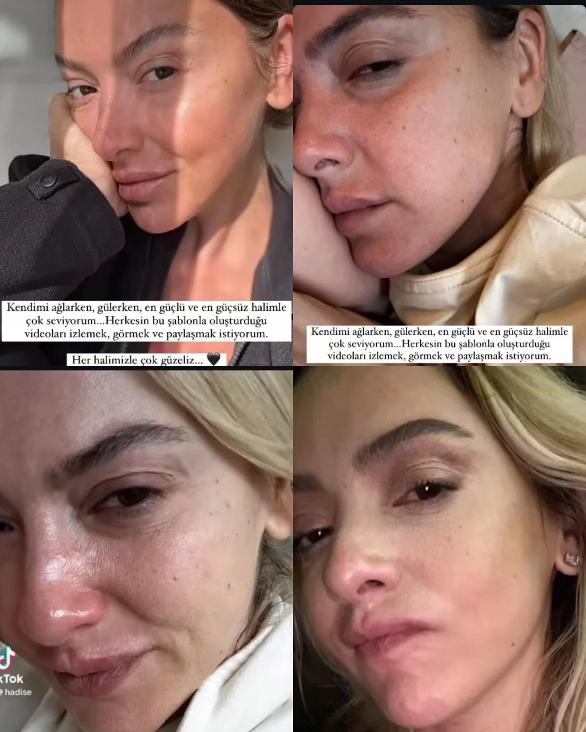 Hadise Gozyaslari Icinde Hayranlarina Her Halimizle Guzeliz Mesaji Verdi2