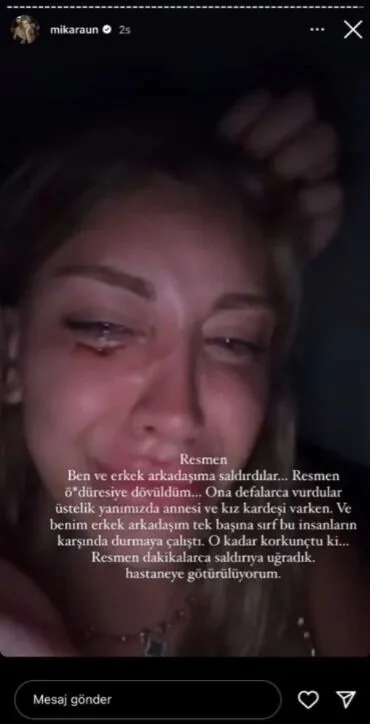 Raun: "Öldüresiye dövüldüm!"