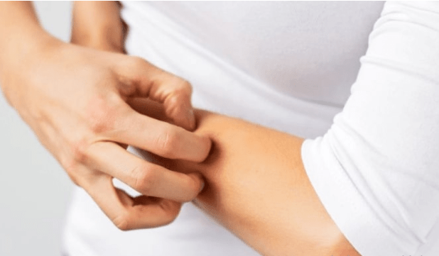 Advantan Krem Ne Ise Yarar 3