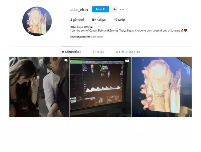 Bebekleri Atlas için yeni adım