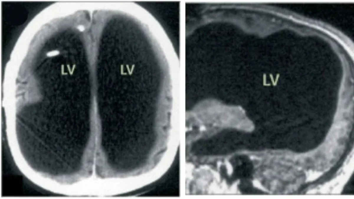 Şikayeti bacak ağrısıydı, şoke eden gerçekle yüzleşti