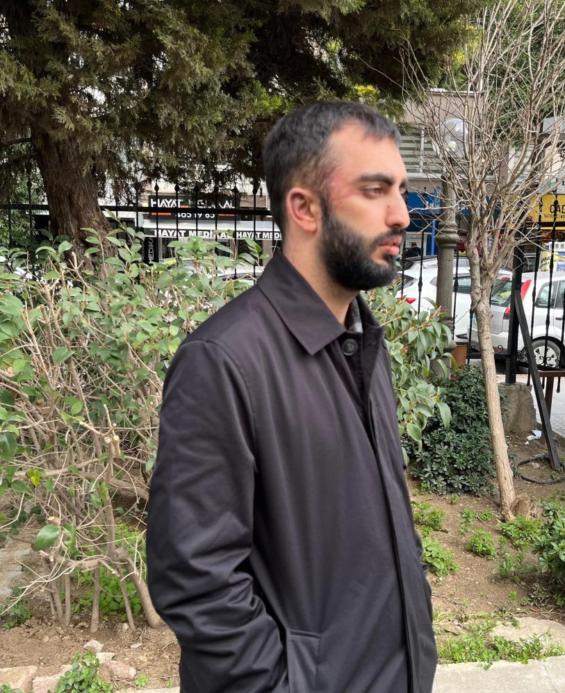 Tekel Bayi Önünde Saldırıya Uğradı