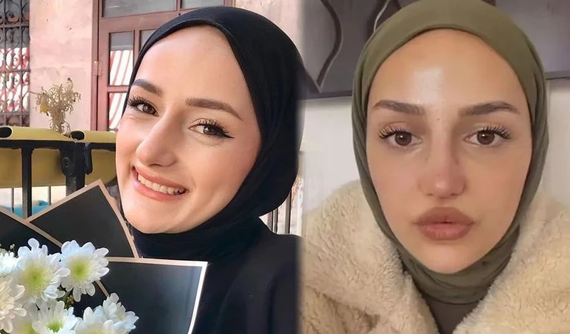 Estetik değişimiyle gündem oldu