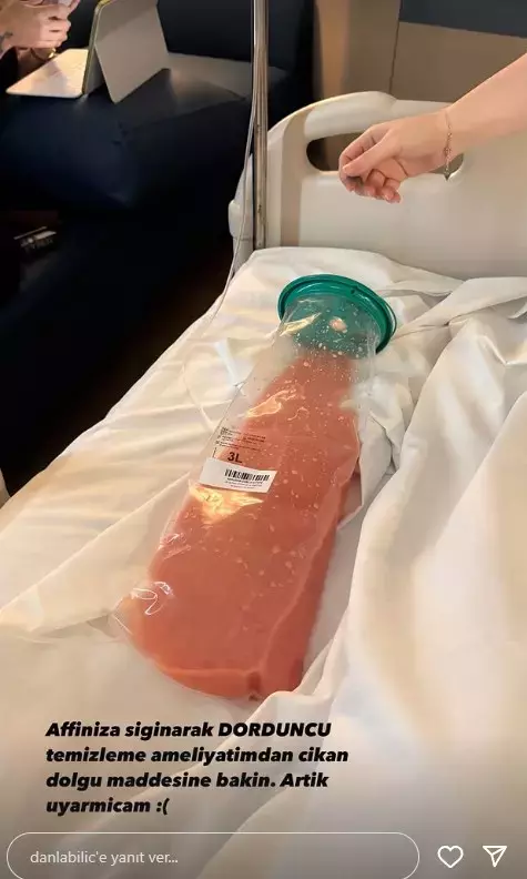 Danla Biliç Dolgu Paylaşımı