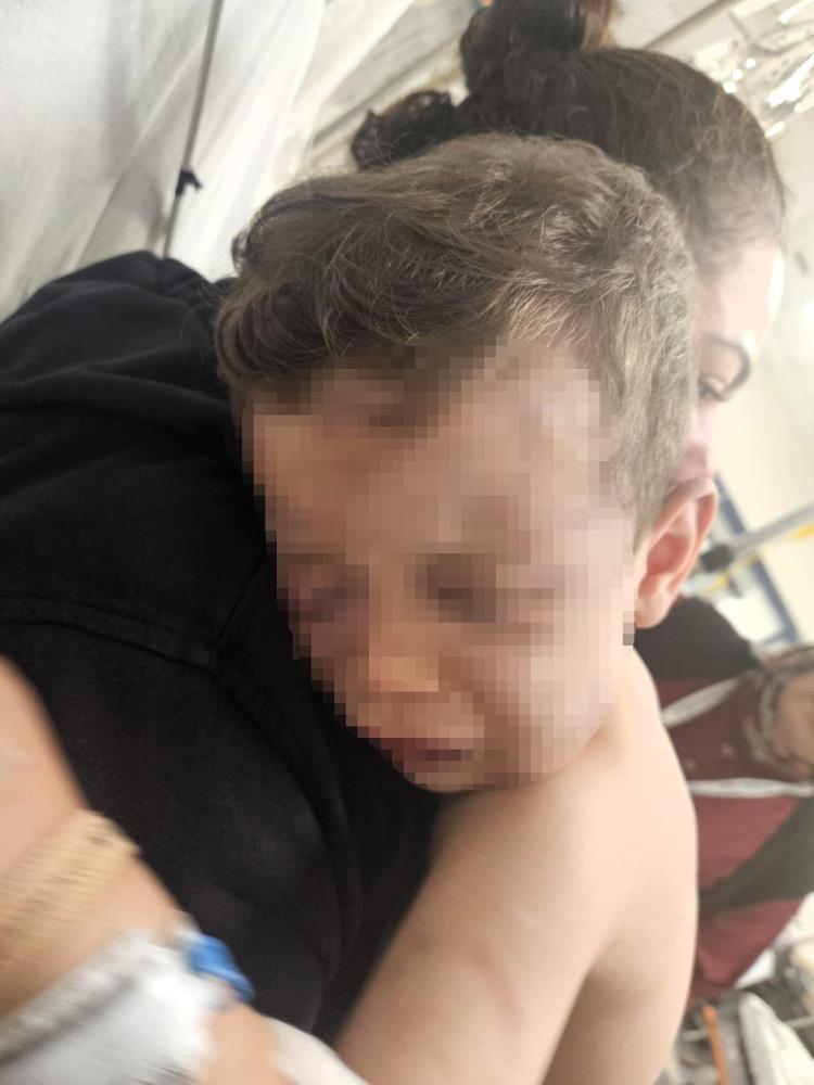 Denizli Darp Edilen Bebek