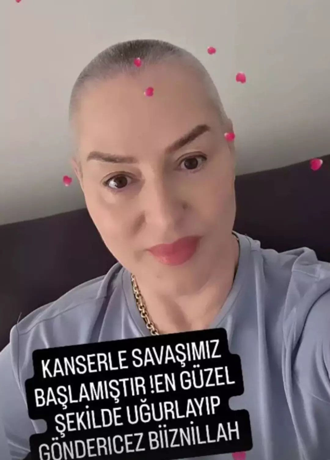 Kanser tedavisi görüyor