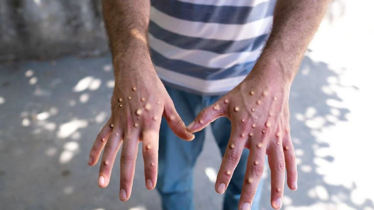 Ülkede gözetim çalışmaları yoğunlaştırıldı