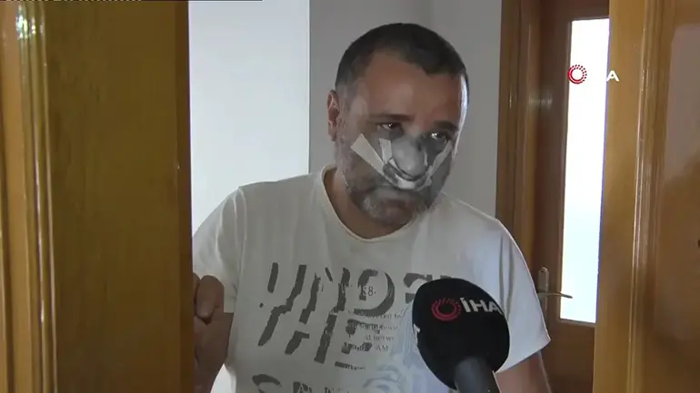 Burnu kırıldı, çocukları korktu