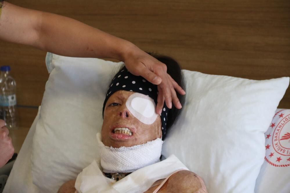 Kezzap Saldırısı 1