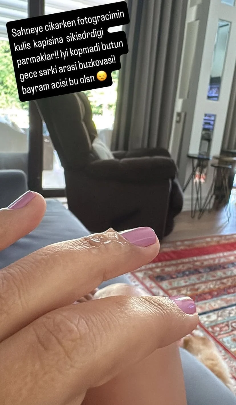 Ağrısına rağmen sahneye çıktı