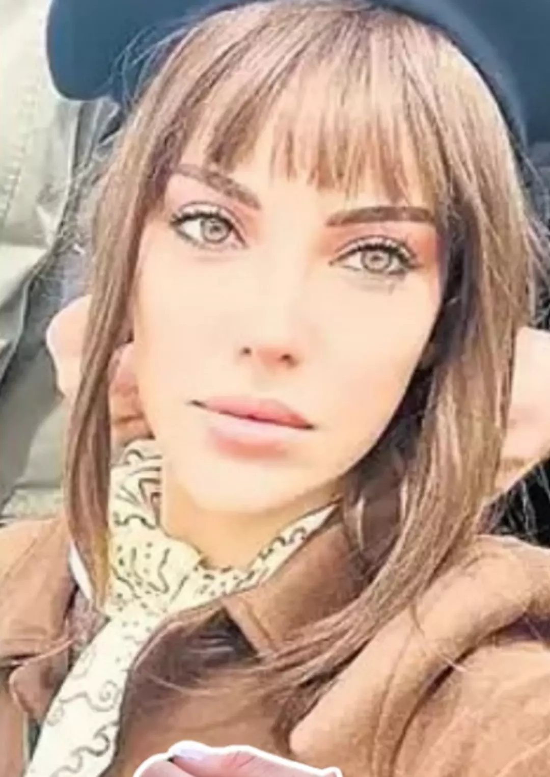 Yüz gerdirme operasyonu sonrasında tepkiler geldi