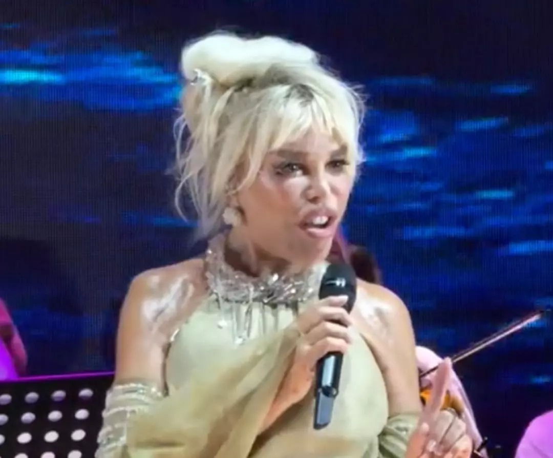 “Estetik yaptırmaktan çekinmiyorum”