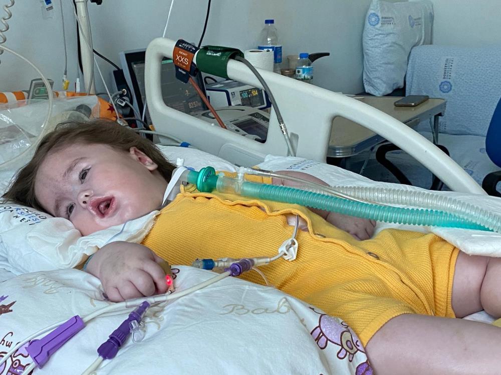 Beyin hasarı oluştu