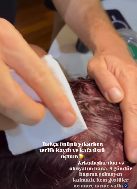 Kazanın detayları ve sanatçının paylaşımı