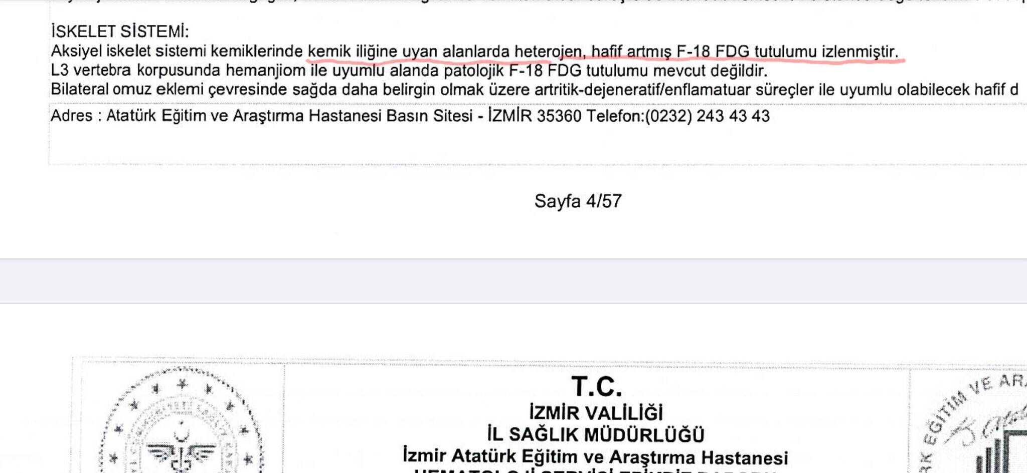 Çalık'ın sağlık raporu