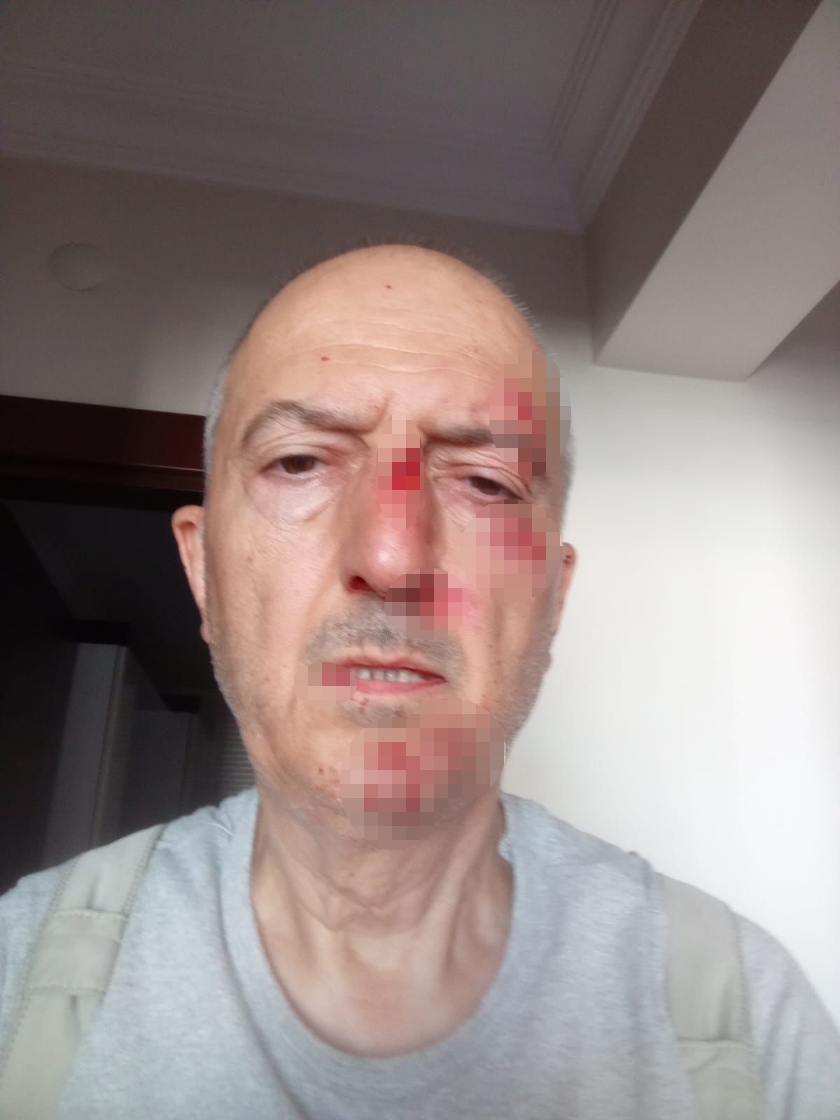 "Gördüğüm şiddet dolayısıyla şikayetçiyim"