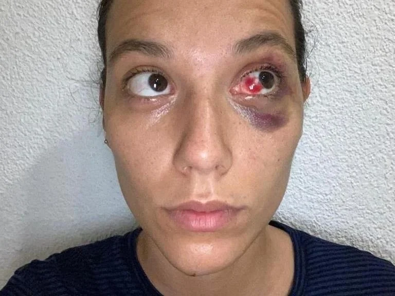 Deniz Bulutsuz’a destek vermişti