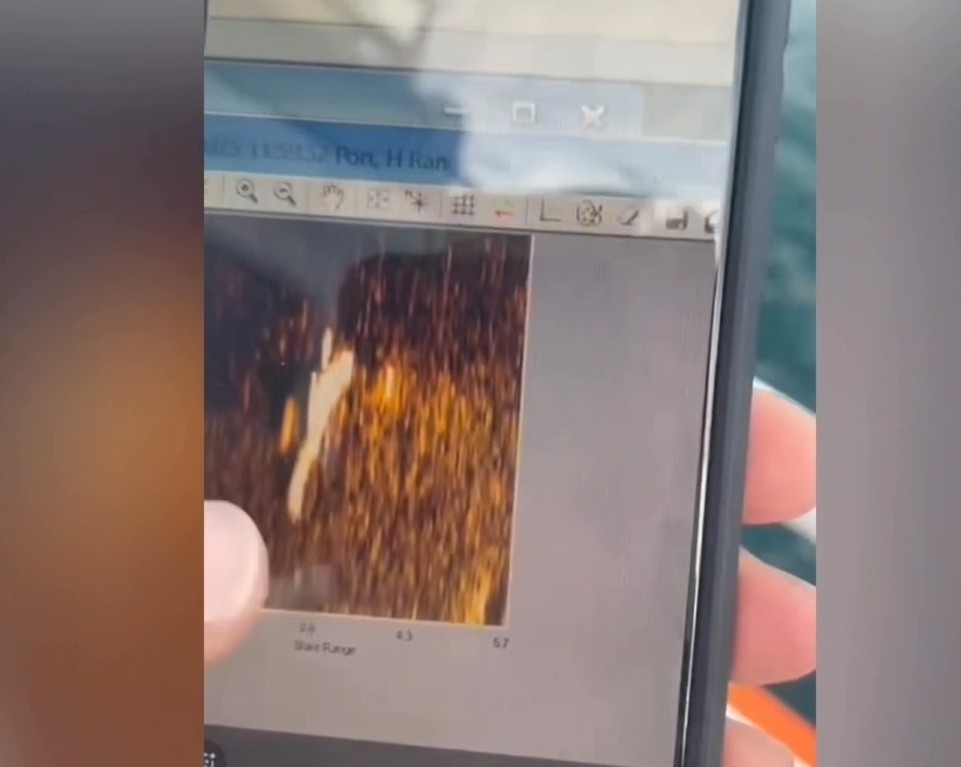 Arkadaşı Kıvanç Tatlıtuğ’un açıklaması