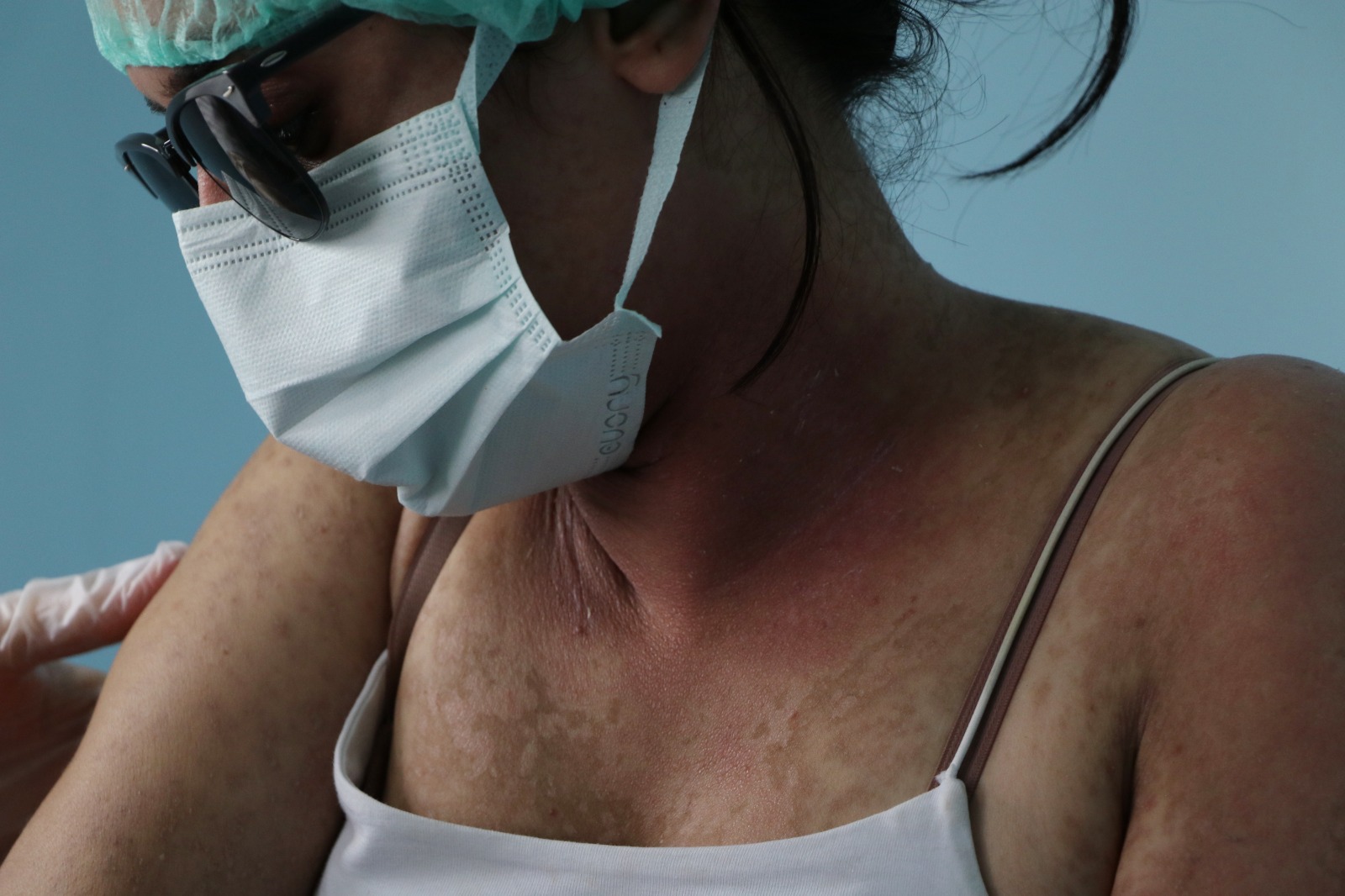 "Adeta kezzap etkisine şahit olduk”