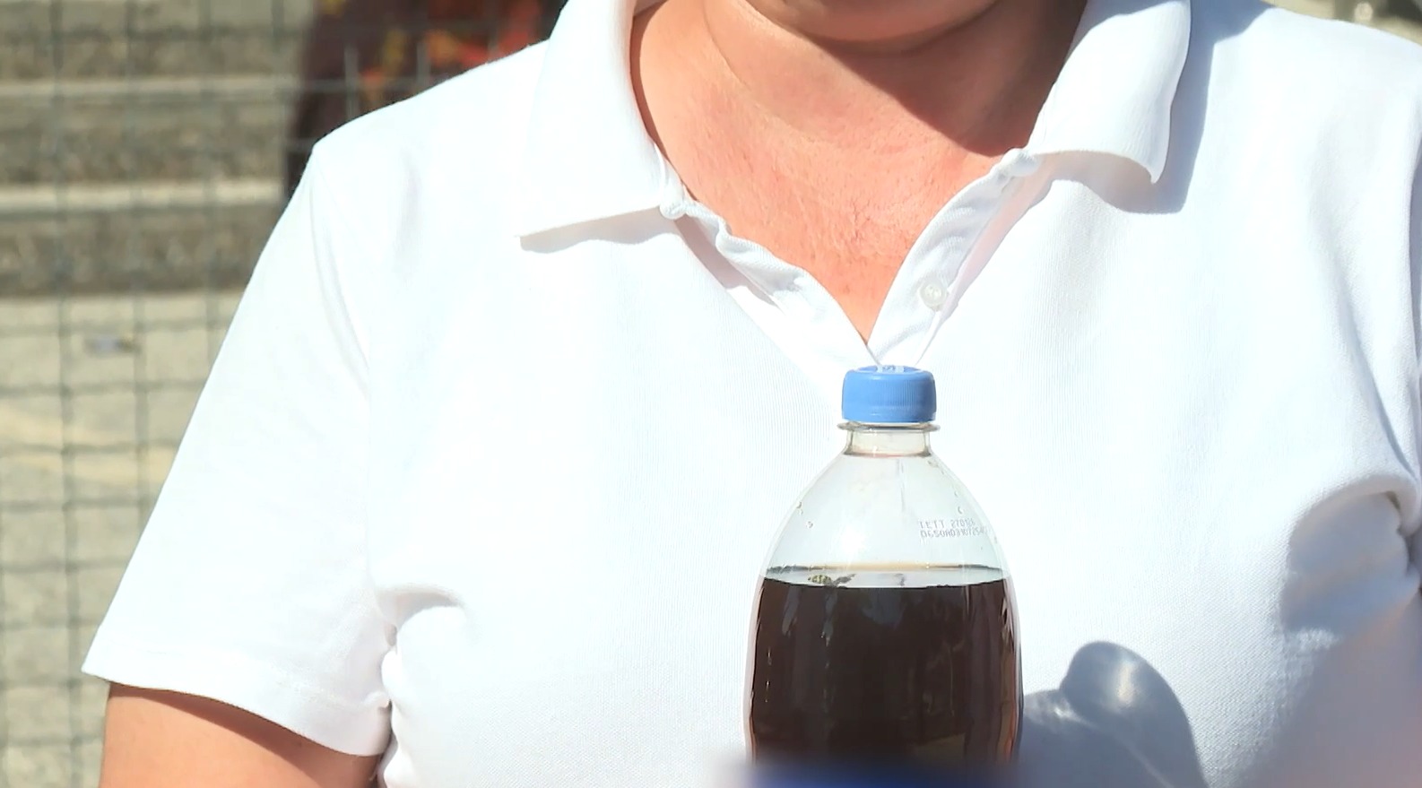 Arıya alerjileri olabilirdi