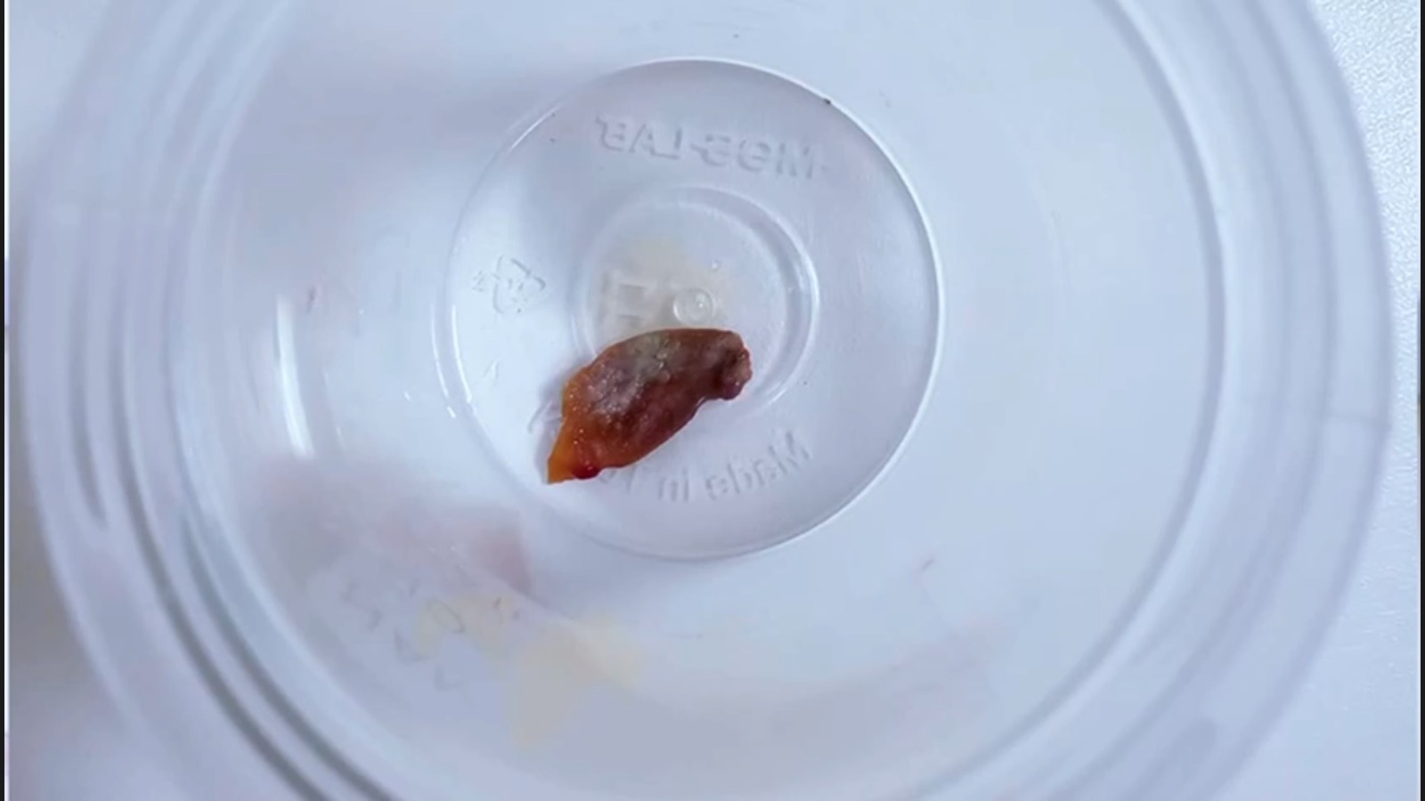 Görüntüleme ve tedavi süreci