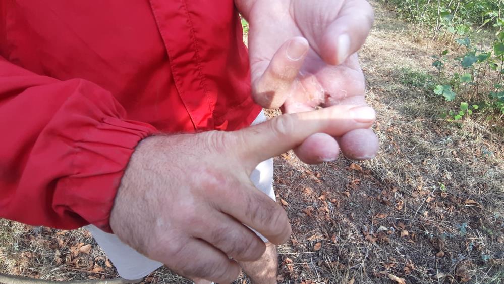 Saldırıya Uğrayan Adam 2