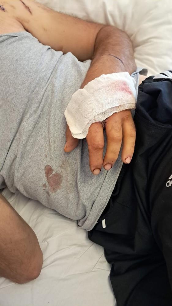 Saldırıya Uğrayan Adam