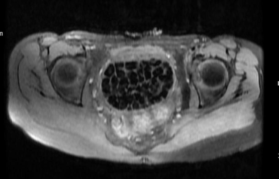 Nadir hastalığı nedeniyle uzun süren sancıları vardı