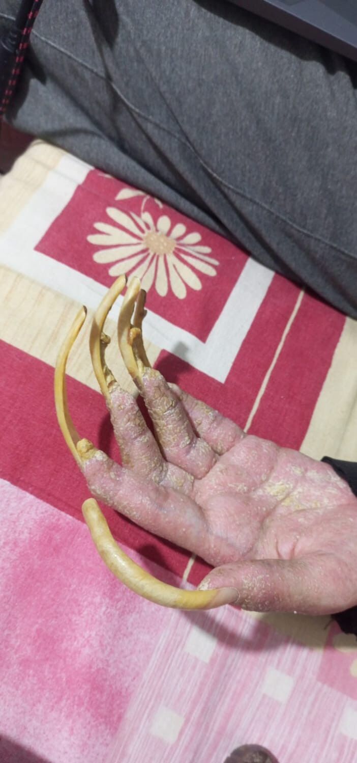 Gencin çaresizliği: "Yaşamak için mecburum"