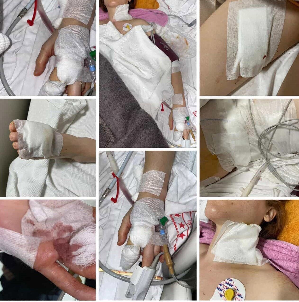 Ağır yaralı kadının tedavisi sürüyor, saldırgan yakalandı