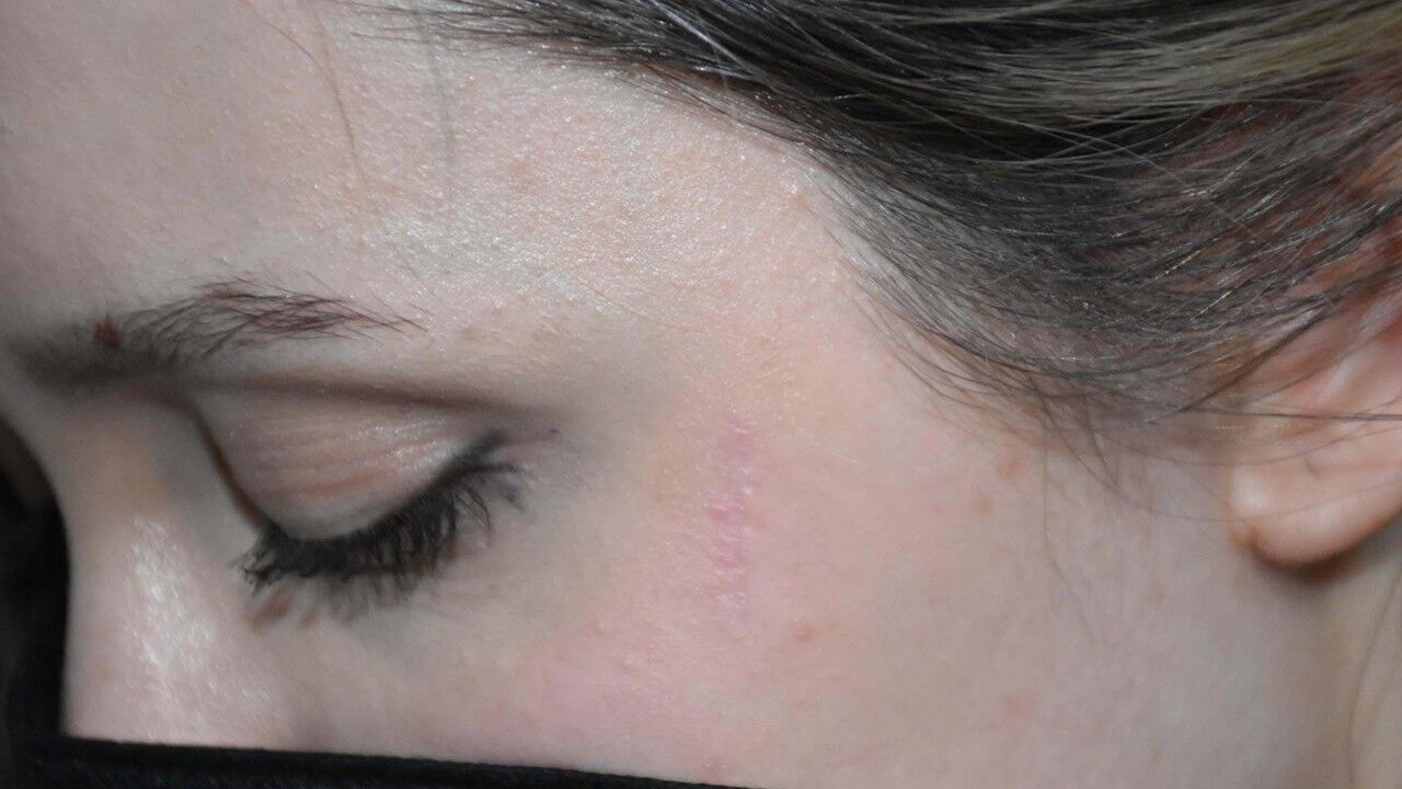 Kemalpaşa Bıçaklı Saldırı 1