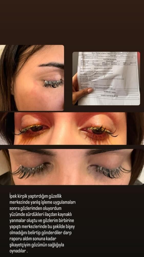 Güzellik Merkezi Kirpik Işlemi 2