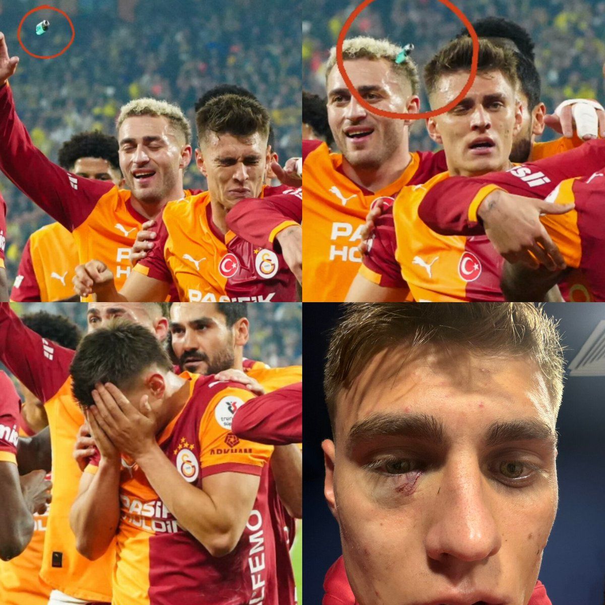 Kazımcan çakmak darbesiyle yaralandı