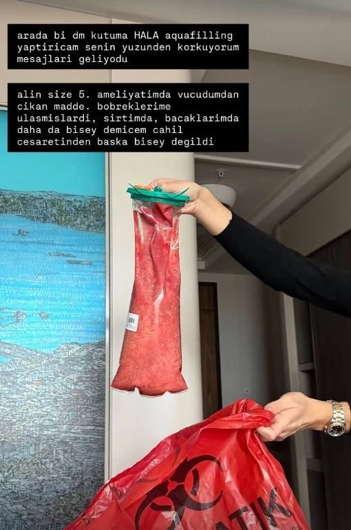 Danla Bilic Ameliyatt