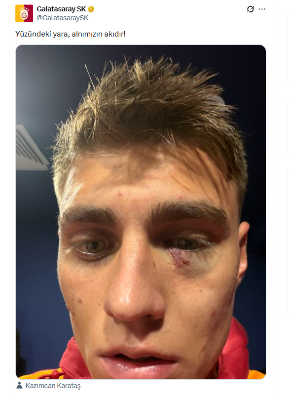 Sosyal medyada tepkiler çığ gibi büyüdü