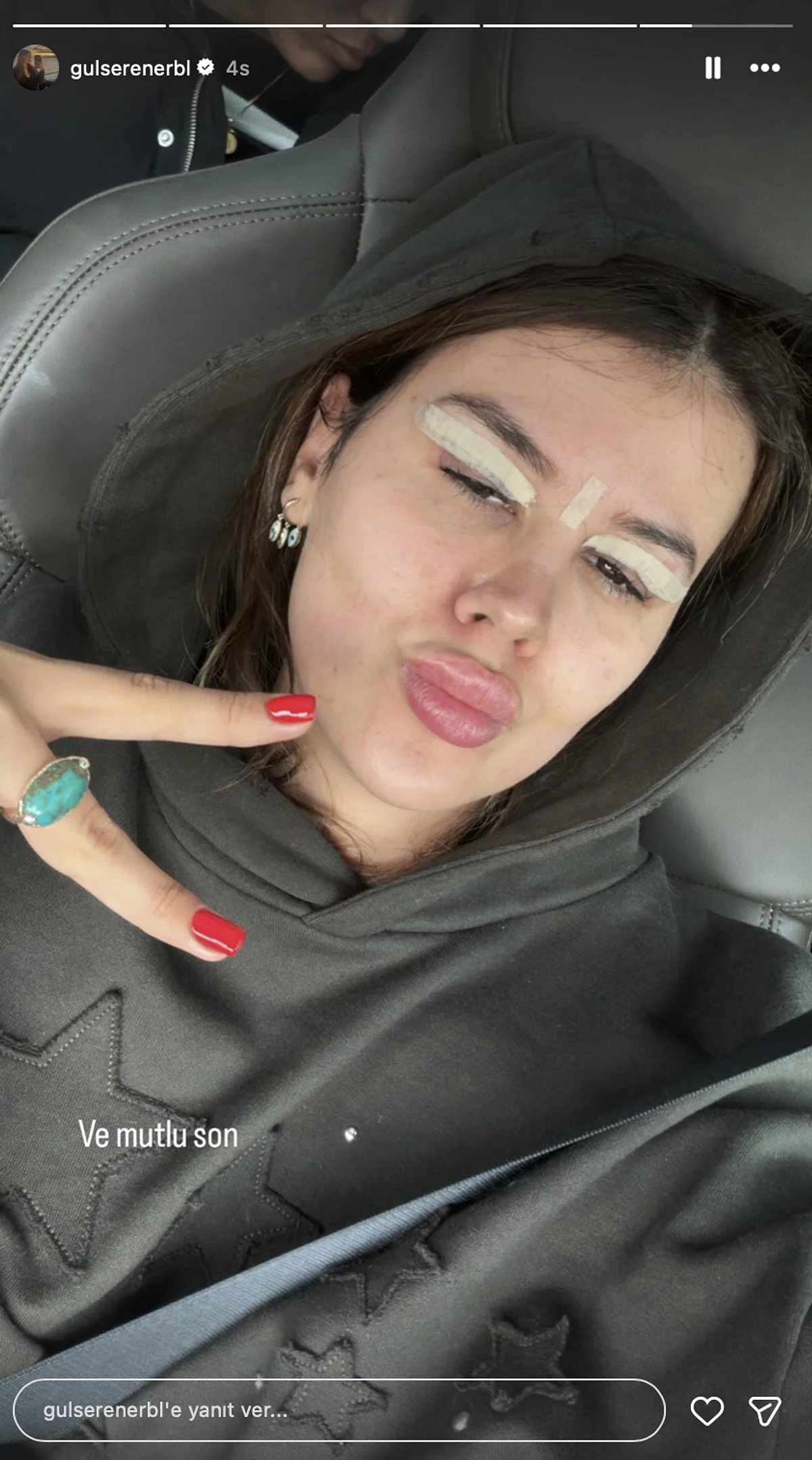 Gülseren Ceylan Ameliyat