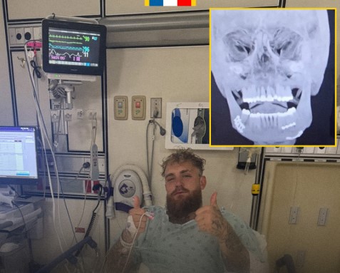 Jake Paul bir süre sıvıyla beslenmek zorunda kalacak