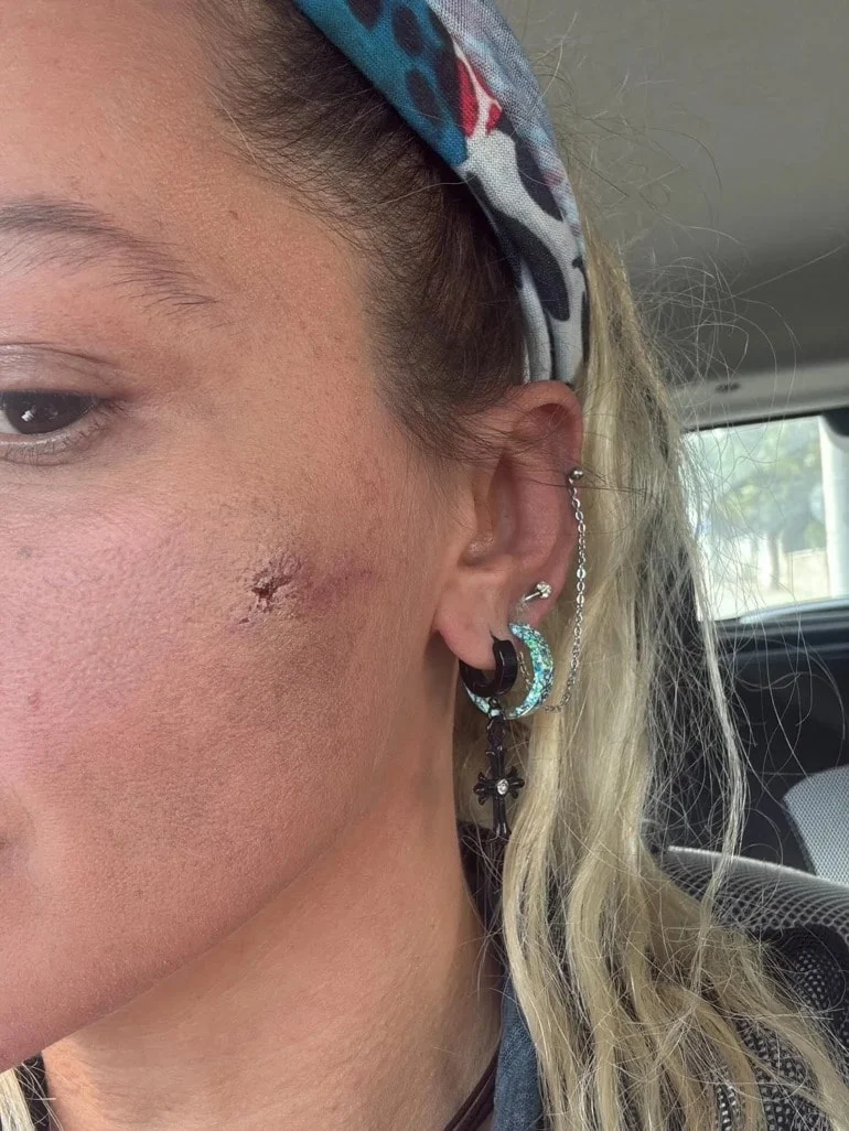 Görüntüler büyük tepki çekti