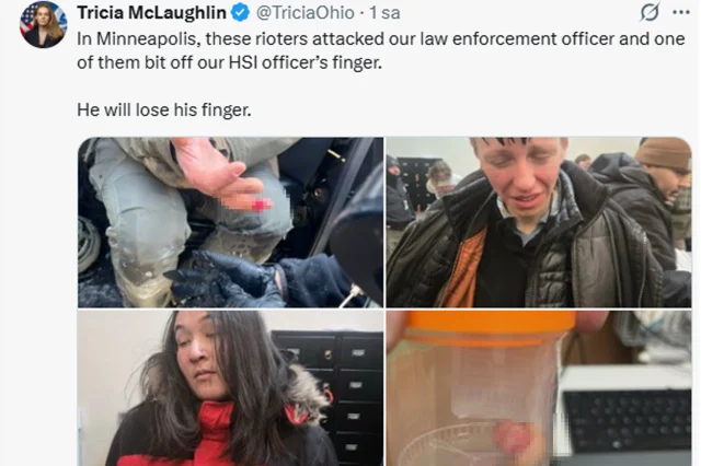 Polisin Parmağının Isırılarak Koparıldığı Görüntüler