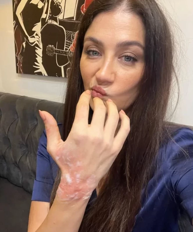 Ceren Benderlioğlu Kaza 1