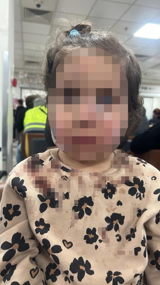 Saldırıya Uğrayan Çocuk