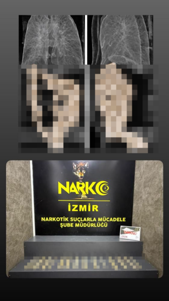 Midesinde Uyuşturucu