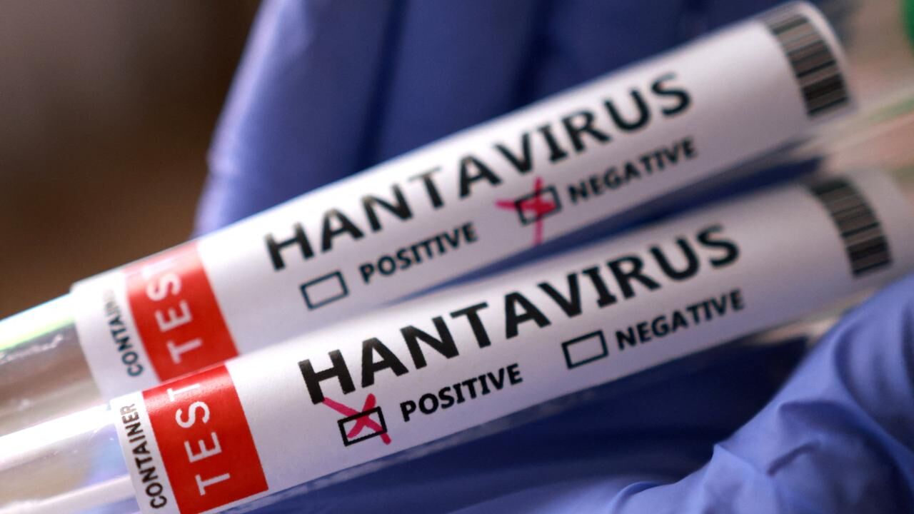Hantavirüs Dsö