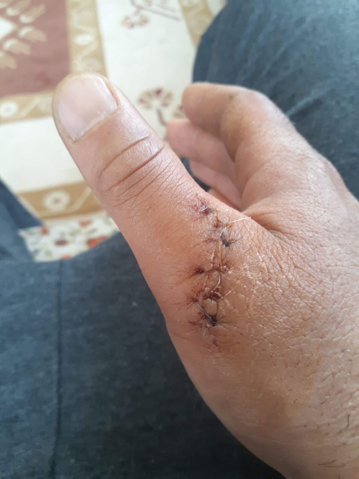 Tire Mağdur Faruk Aras (3)